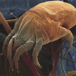 Aspirador Dyson Cinetic acaro